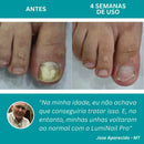 LumiNail Projoy - DeusJoy.com