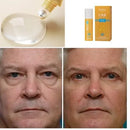 Rejuvenescedor Rolon 5 em 1 - Luteína Glow - DeusJoy.com