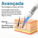 Caneta Laser SkinMedi – Remove Manchas e Verrugas sem Dor - DeusJoy.com