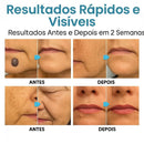 Caneta Laser SkinMedi – Remove Manchas e Verrugas sem Dor - DeusJoy.com