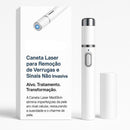 Caneta Laser SkinMedi – Remove Manchas e Verrugas sem Dor - DeusJoy.com