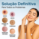 Caneta Laser SkinMedi – Remove Manchas e Verrugas sem Dor - DeusJoy.com