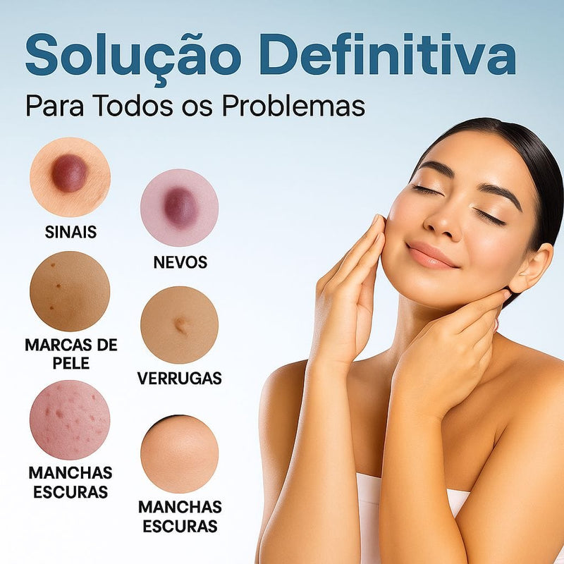 Caneta Laser SkinMedi – Remove Manchas e Verrugas sem Dor - DeusJoy.com