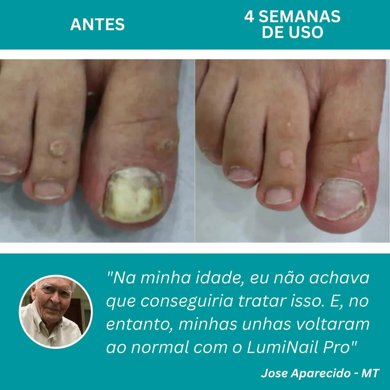 LumiNail Projoy