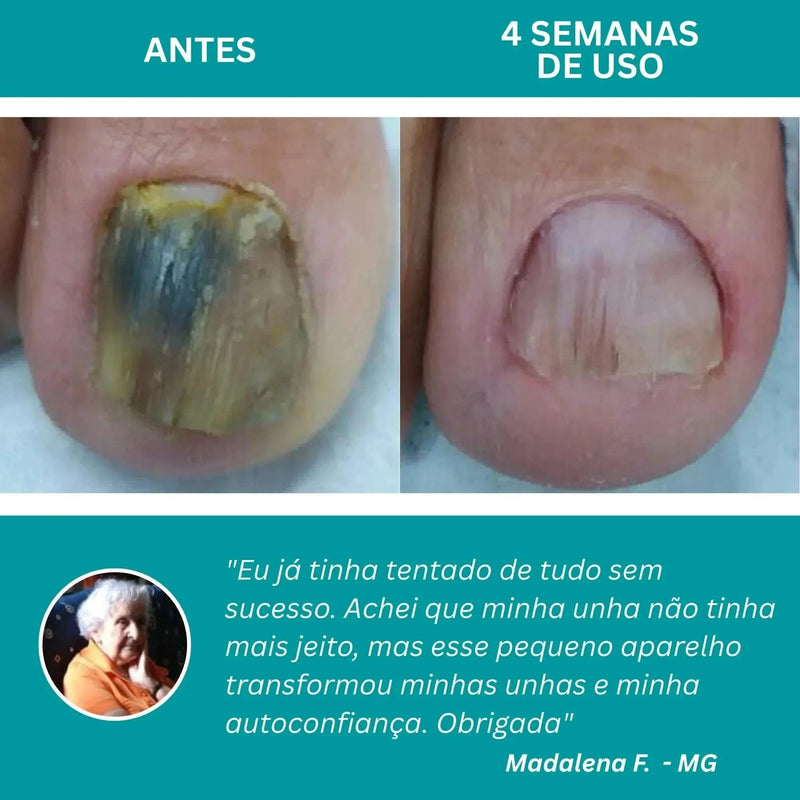 LumiNail Projoy - DeusJoy.com