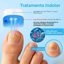 LumiNail Projoy - DeusJoy.com