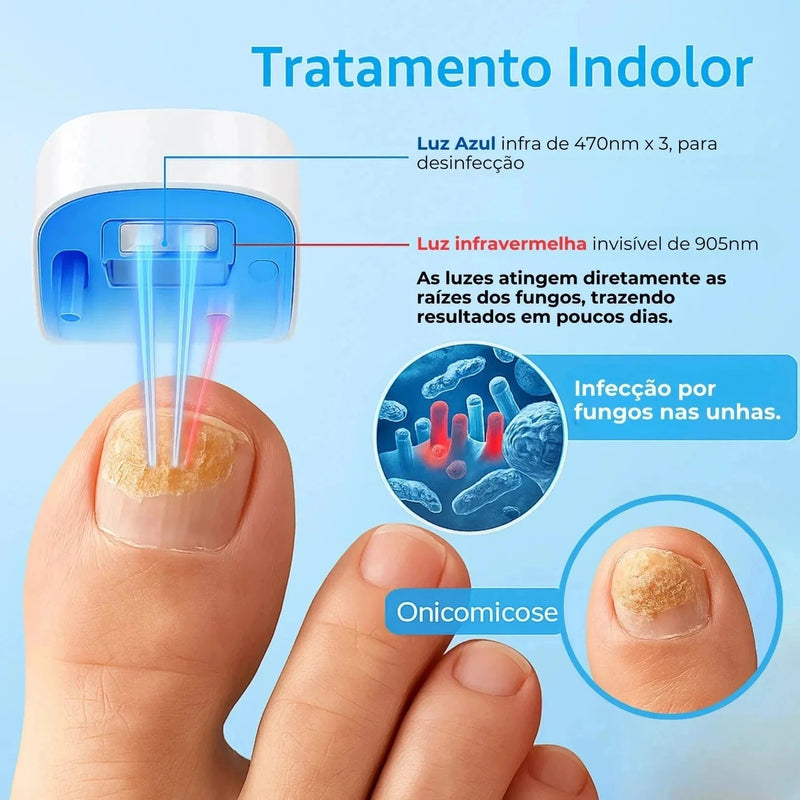 LumiNail Projoy - DeusJoy.com