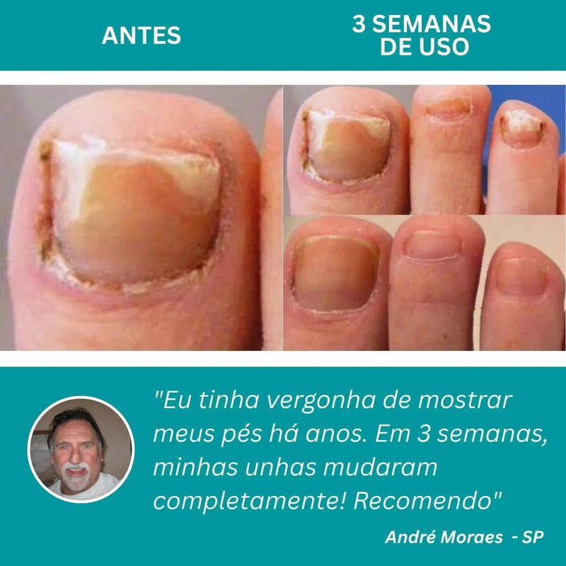 LumiNail Projoy - DeusJoy.com