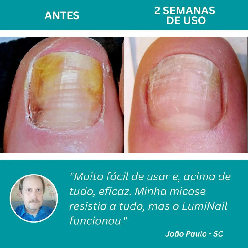 LumiNail Projoy - DeusJoy.com