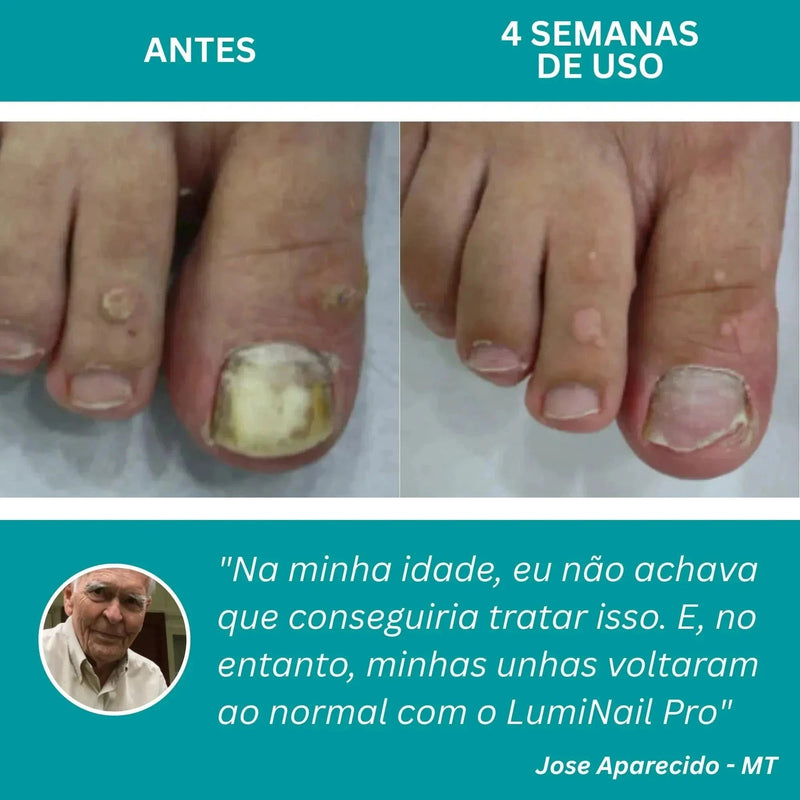 LumiNail Projoy - DeusJoy.com