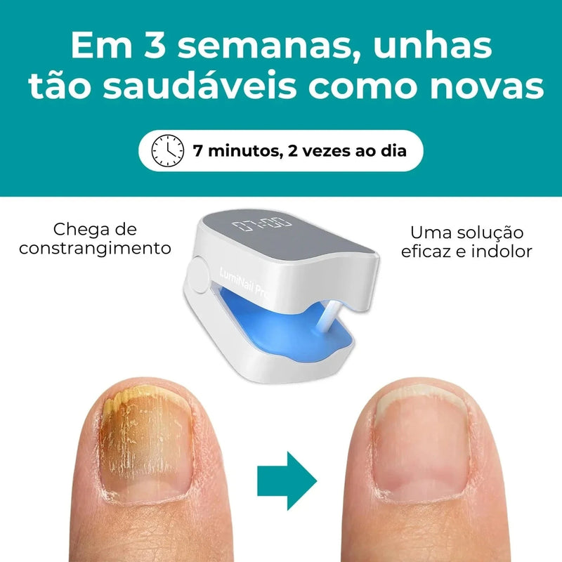 LumiNail Projoy - DeusJoy.com