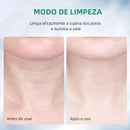 Massageador Facial com Fototerapia Anti - Rugas - DeusJoy.com
