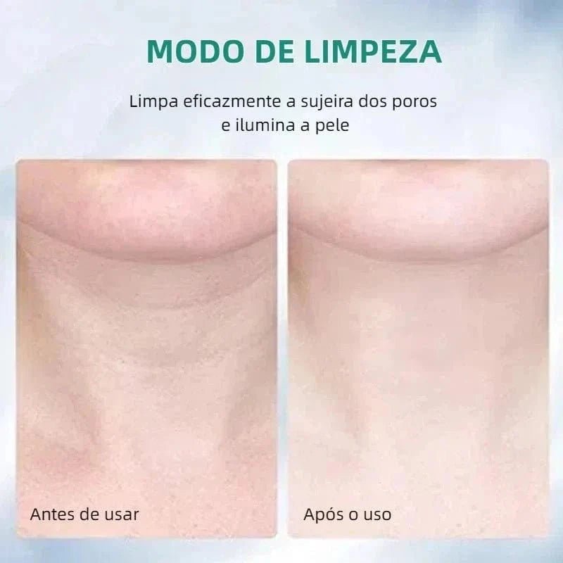 Massageador Facial com Fototerapia Anti - Rugas - DeusJoy.com