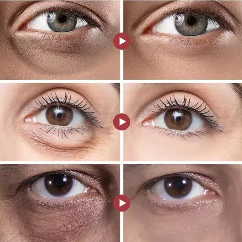 Rejuvenescedor  Rolon 5 em 1 - Luteína Glow